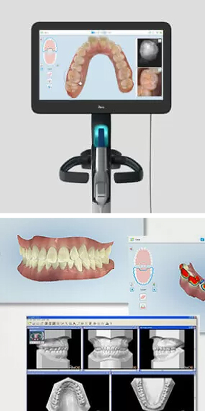 iTero Element 5D Plus