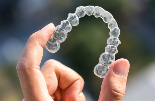 インビザライン