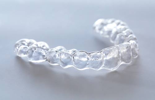 インビザライン