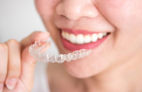 インビザライン